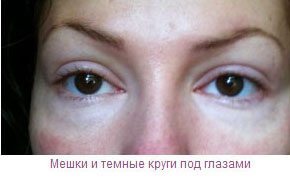 beauty eye